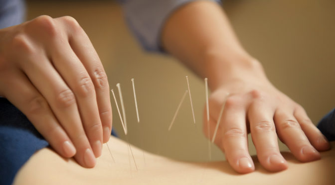 Nova pesquisa: acupuntura alivia dores na lombar